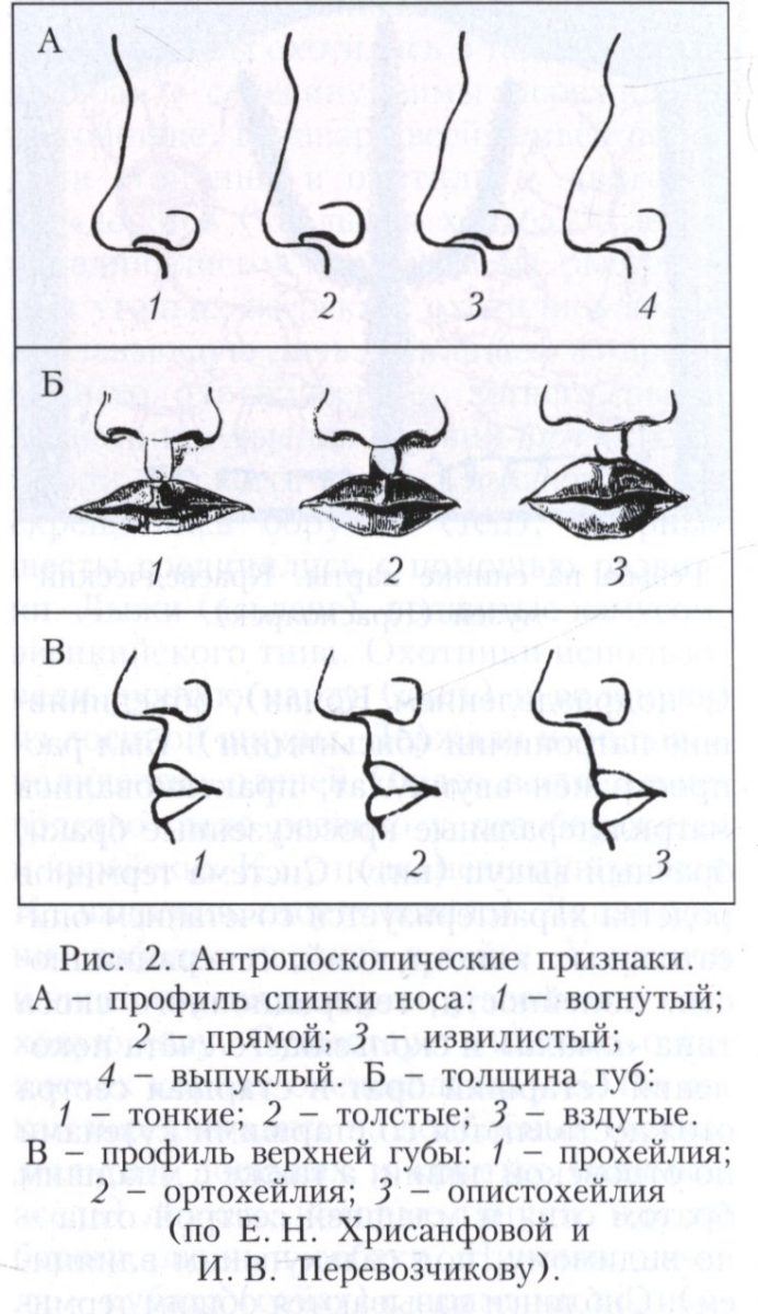 Кефалометрия 