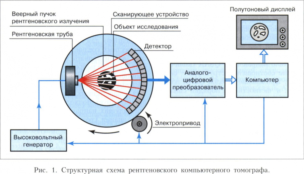 Компьютерный томограф